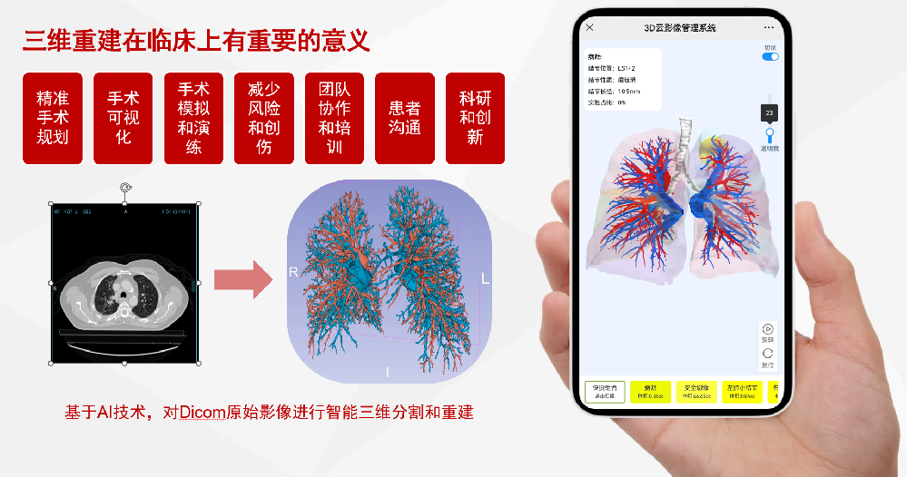 医疗影像三维智能重建及AI